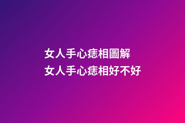 女人手心痣相圖解 女人手心痣相好不好